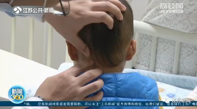 20多厘米筷子贯穿孩子喉咙!家长千万当心