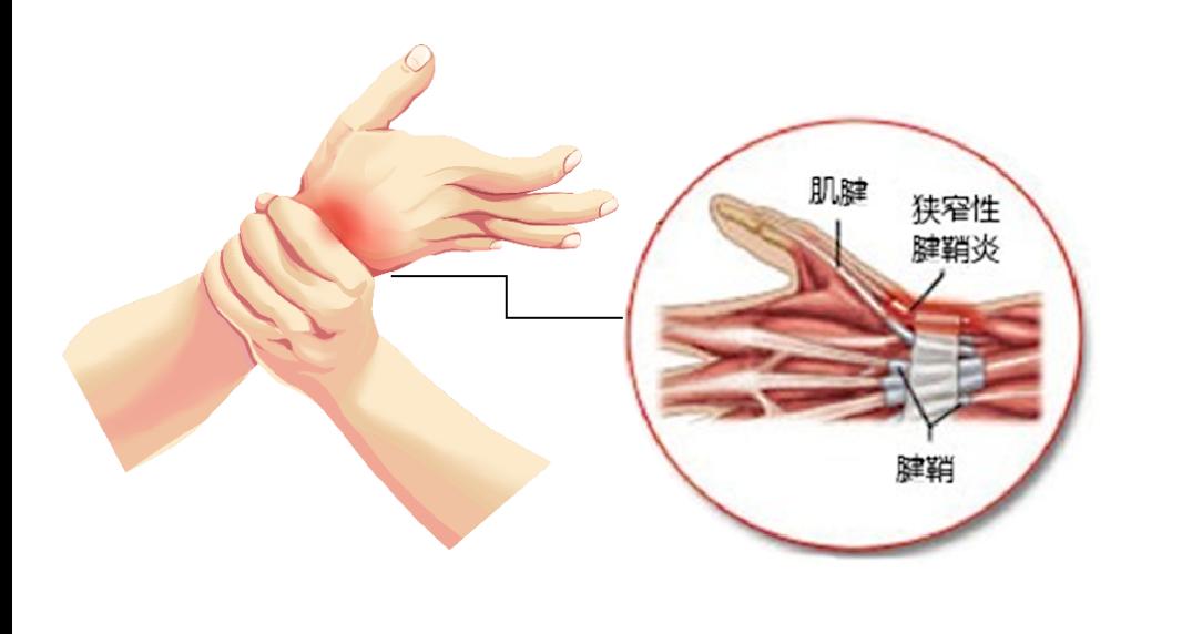 予以超声评估 超声引导下封闭 小针刀治疗,效果立竿见影.